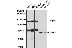 Western blot analysis of extracts of various cell lines using TMPO Polyclonal Antibody at dilution of 1:1000. (Thymopoietin Antikörper)