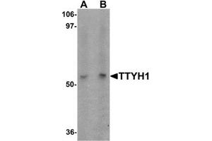 Western blot analysis of TTYH1 in Raji cell lysate with TTYH1 antibody at (A) 1 and (B) 2 ug/mL.