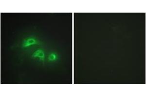 Immunofluorescence analysis of HepG2 cells, using KAD1 Antibody . (Adenylate Kinase 1 Antikörper  (AA 101-150))