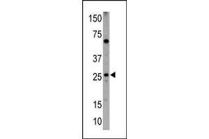 Western blot analysis of anti-NIP1 BH3 Domain Pab (ABIN388133 and ABIN2846370) in HL60 cell lysates (35 μg/lane). (BNIP1 Antikörper  (AA 92-127))