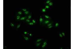 anti-P21-Activated Kinase 4 (PAK4) (pSer474), (pSer560), (pSer602) antibody