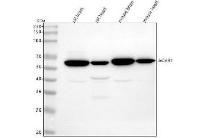 Western blot analysis of ACVR1 using anti-ACVR1 antibody (ABIN7603898).