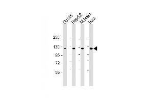 Lane 1: Du145, Lane 2: HepG2, Lane 3: mouse brain, Lane 4: Hela cell lysate at 20 µg per lane, probed with bsm-51347M DAB2IP (1626CT702. (DAB2IP Antikörper)