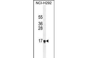 HEPN1 Antibody (N-term) (ABIN654808 and ABIN2844482) western blot analysis in NCI- cell line lysates (35 μg/lane).