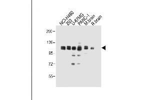 All lanes : Anti-XYLT1 Antibody (N-term) at 1:1000 dilution Lane 1: NCI- whole cell lysate Lane 2: 293 whole cell lysate Lane 3: U-87MG whole cell lysate Lane 4: NC-1 whole cell lysate Lane 5: Mouse brain whole cell lysate Lane 6: Rat brain whole cell lysate Lysates/proteins at 20 μg per lane. (XYLT1 Antikörper  (N-Term))