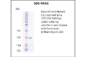 SDS-PAGE (SDS) image for Interleukin 11 (IL11) (Active) protein (ABIN5509338) (IL-11 Protein)