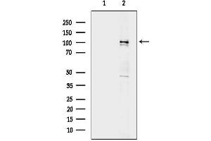 Western blot analysis of lysates from Mouse lung, using CTNN Antibody.