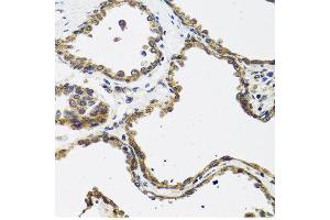Immunohistochemistry of paraffin-embedded human prostate using CALCB antibody at dilution of 1:100 (40x lens). (CALCB Antikörper)