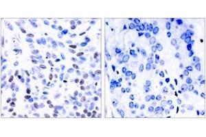 Immunohistochemistry (IHC) image for anti-Nuclear Factor of kappa Light Polypeptide Gene Enhancer in B-Cells 2 (NFKB2) (AA 833-882) antibody (ABIN2889035) (NFKB2 Antikörper  (AA 833-882))