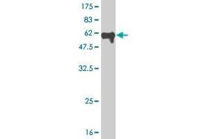 Western Blot detection against Immunogen (59. (MEOX2 Antikörper  (AA 1-303))