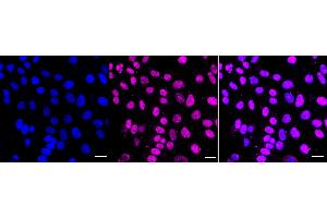 Immunocytochemical staining of HepG2 cells with DGCR8 antibody (ABIN7798333), 1:1,000). (Rekombinanter DGCR8 Antikörper)