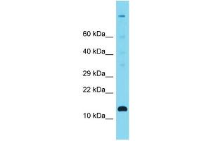 Host: Rabbit Target Name: C12orf23 Sample Type: Fetal Heart lysates Antibody Dilution: 1. (C12ORF23 Antikörper  (C-Term))