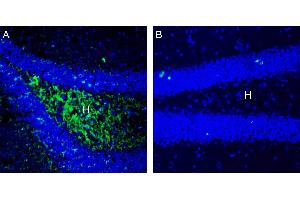 Expression of SLC7A8 in mouse hippocampus.