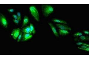 Immunofluorescent analysis of HepG2 cells using ABIN7149738 at dilution of 1:100 and Alexa Fluor 488-congugated AffiniPure Goat Anti-Rabbit IgG(H+L) (DEPDC1B Antikörper  (AA 343-529))