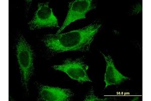 Immunofluorescence of monoclonal antibody to CAST on HeLa cell.