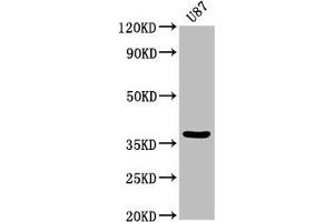 Western Blot Positive WB detected in: U87 whole cell lysate All lanes: GJD2 antibody at 3. (GJD2 Antikörper  (AA 99-197))