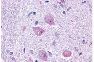 Anti-CHRM4 antibody  ABIN1048444 IHC staining of human brain, neurons and glia. (CHRM4 Antikörper  (Cytoplasmic Domain))