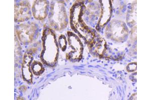 Paraformaldehyde-fixed, paraffin embedded Human kidney, Antigen retrieval by boiling in sodium citrate buffer (pH6) for 15min, Block endogenous peroxidase by 3% hydrogen peroxide for 30 minutes, Blocking buffer at 37°C for 20min, Antibody incubation with Cytochrome C (1F10) Monoclonal Antibody  at 1:50 overnight at 4°C, followed by a conjugated secondary and DAB staining. (Cytochrome C Antikörper)