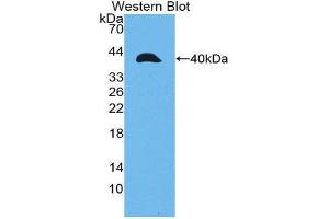 Western Blotting (WB) image for anti-Matrix Metalloproteinase 23A (MMP23A) (AA 71-383) antibody (ABIN1980456) (MMP23A Antikörper  (AA 71-383))