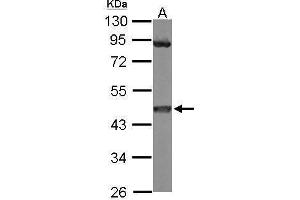 WB Image Sample (50 ug of whole cell lysate) A: mouse brain 10% SDS PAGE antibody diluted at 1:3000 (MEK1 Antikörper)