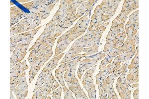 ABIN6265333 and ABIN6278532 at 1/100 staining mouse ovarian tissue by IHC-P. (STEAP1 Antikörper  (N-Term))