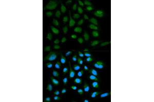 Immunofluorescence (IF) image for anti-SH2 Domain Containing 1A (SH2D1A) (AA 1-128) antibody (ABIN3021536)
