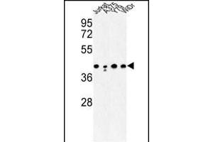 Western blot analysis of CANT1 Antibody (N-term) (ABIN652769 and ABIN2842506) in Jurkat, , Y79, WiDr cell line lysates (35 μg/lane). (CANT1 Antikörper  (N-Term))