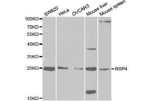 Western blot analysis of extracts of various cell lines, using RBP4 antibody. (RBP4 Antikörper  (AA 19-201))