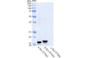 Western blot analysis of Human Recombinant Protein showing detection of Alpha Synuclein protein using Rabbit Anti-Alpha Synuclein Polyclonal Antibody (ABIN6698742). (SNCA Antikörper  (Alkaline Phosphatase (AP)))