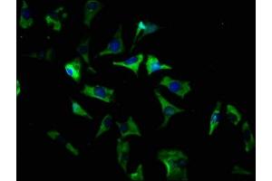 Immunofluorescence staining of SH-SY5Y cells with ABIN7170227 at 1:166, counter-stained with DAPI. (SLC35D3 Antikörper  (AA 304-416))