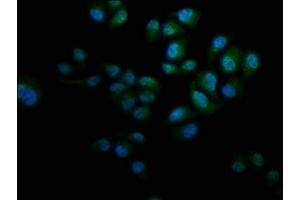 Immunofluorescence staining of Hela cells with ABIN7157376 at 1:133, counter-stained with DAPI. (KRT12 Antikörper  (AA 1-178))
