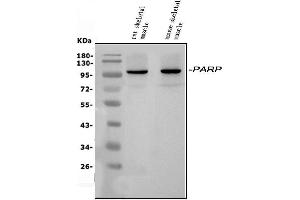 anti-Poly (ADP-Ribose) Polymerase Family, Member 9 (PARP9) (AA 117-824) antibody