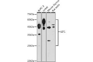Western blot analysis of extracts of various cell lines, using LEF1 antibody (ABIN1680678, ABIN5663809, ABIN5663811 and ABIN6214021) at 1:1000 dilution.