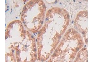 Detection of TGFb3 in Human Kidney Tissue using Polyclonal Antibody to Transforming Growth Factor Beta 3 (TGFb3)