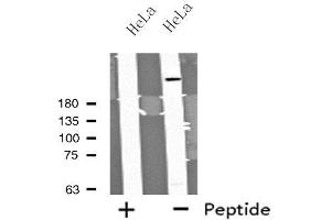 Western blot analysis of extracts from HeLa cells using MYO9B antibody.