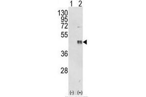 Western blot analysis of CEBPB (arrow) using rabbit polyclonal CEBPB Antibody (C-term) . (CEBPB Antikörper  (C-Term))