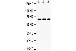 Western Blotting (WB) image for anti-Cryptochrome 1 (Photolyase-Like) (CRY1) (AA 153-189), (N-Term) antibody (ABIN3042761)