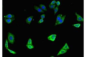 Immunofluorescent analysis of HepG2 cells using ABIN7172282 at dilution of 1:100 and Alexa Fluor 488-congugated AffiniPure Goat Anti-Rabbit IgG(H+L) (TLR7 Antikörper  (AA 899-1022))