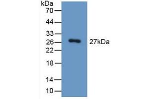 Detection of Recombinant HGD, Mouse using Polyclonal Antibody to Homogentisate-1,2-Dioxygenase (HGD) (HGD Antikörper  (AA 190-429))