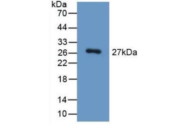 HGD Antikörper  (AA 190-429)