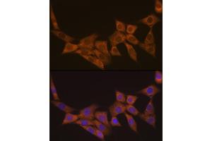 Immunofluorescence analysis of NIH-3T3 cells using DCP1A Rabbit mAb (ABIN7266678) at dilution of 1:100 (40x lens). (DCP1A Antikörper)
