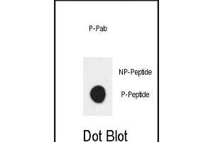 Dot blot analysis of anti-Phospho-ERBB3 (Tyr1289) Antibody Phospho-specific Pab (ABIN1881314 and ABIN2839805) on nitrocellulose membrane.