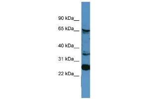 WB Suggested Anti-CANX Antibody Titration: 0. (Calnexin Antikörper  (C-Term))