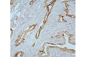 IHC analysis of MMP1 using anti-MMP1 antibody (ABIN7599873).