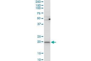 RPL21 polyclonal antibody (A01), Lot # 051220JC01. (RPL21 Antikörper  (AA 2-85))
