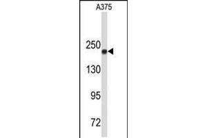Western blot analysis of TOP2A Antibody in A375 cell line lysates (35ug/lane)