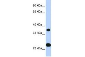 Image no. 1 for anti-Solute Carrier Family 25, Member 35 (SLC25A35) (N-Term) antibody (ABIN6740860) (SLC25A35 Antikörper  (N-Term))