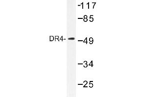 Image no. 1 for anti-Tumor Necrosis Factor Receptor Superfamily, Member 10a (TNFRSF10A) antibody (ABIN272303) (TNFRSF10A Antikörper)