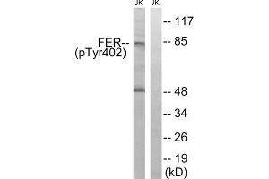 Western blot analysis of extracts from Jurkat cells, treated with starved (24hours), using FER (Phospho-Tyr402) antibody. (FER Antikörper  (pTyr402))