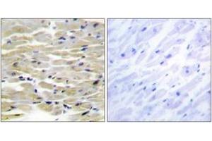 Immunohistochemistry analysis of paraffin-embedded human heart tissue, using TENS3 Antibody. (TNS3 Antikörper  (AA 541-590))